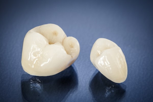 What Are CEREC® Crowns?